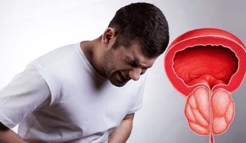 Symptoms and Treatment