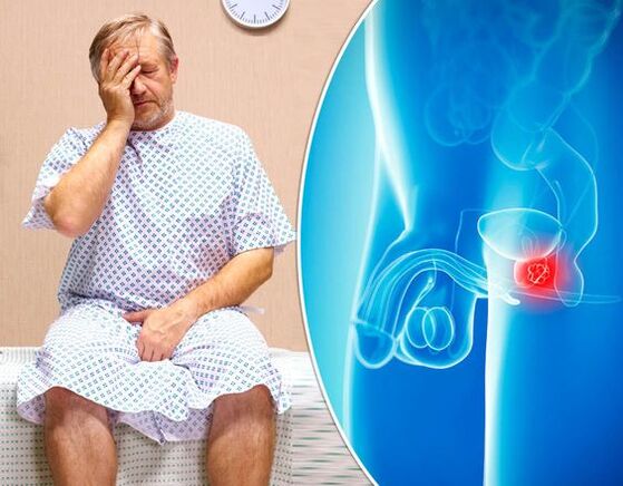Prostatitis symptoms